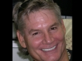 Veneers