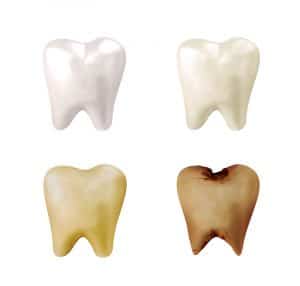 What causes teeth stains