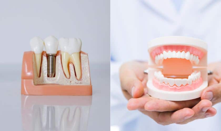 dentures and dental implants