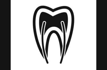 Pain Free Root Canal Therapy