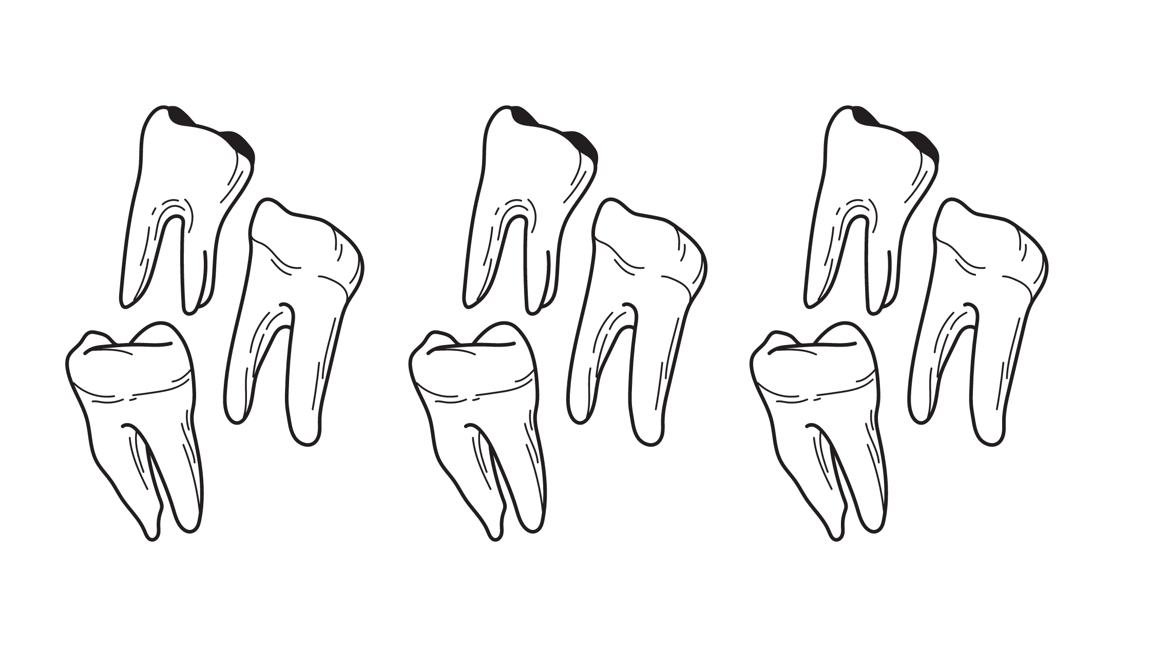 teeth and enamel loss
