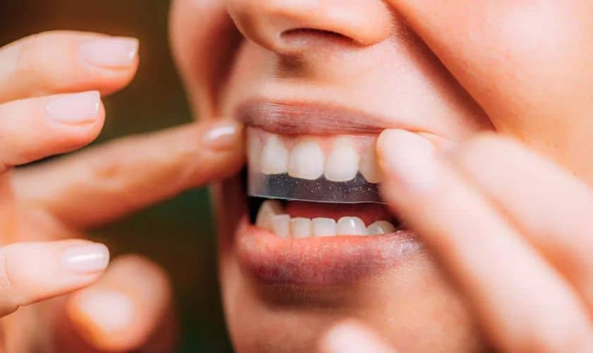 Teeth whitening strips